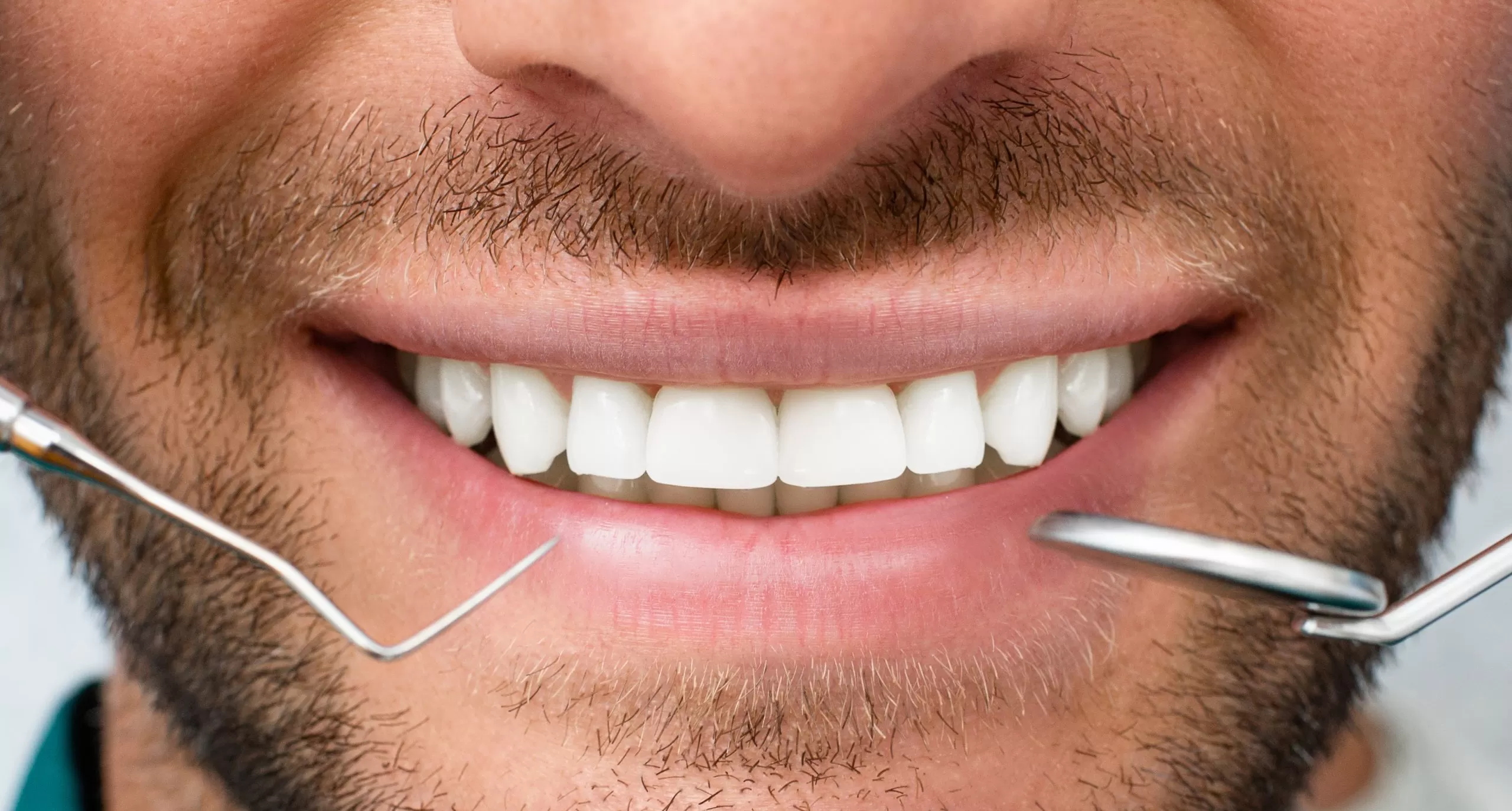 Non-invasive cosmetic dental treatments
