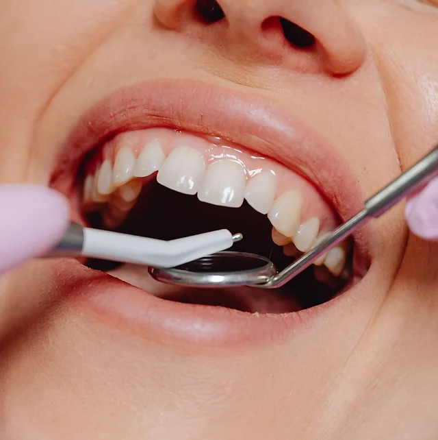 NonInvasive Cosmetic Dental Treatments, minimally invasive dental aesthetics, cosmetic dentistry without surgery, gentle smile makeover, nonsurgical teeth enhancement, dental beautification without cutting, modern aesthetic dental procedures, nocut dental cosmetics, soft touch dental aesthetics, nonsurgical cosmetic dentistry, painless dental beautification, noknife cosmetic dental solutions, cuttingedge aesthetic dentistry, dental contouring without surgery, innovative cosmetic dental options, nonaggressive aesthetic dentistry, gentle dental cosmetic procedures, noninvasive dental whitening, lowimpact dental cosmetics, aesthetic dental treatments without surgery, nonintrusive smile design, modern nonsurgical dental aesthetics, noninvasive dental veneers, simple dental cosmetics, innovative nonsurgical smile enhancements